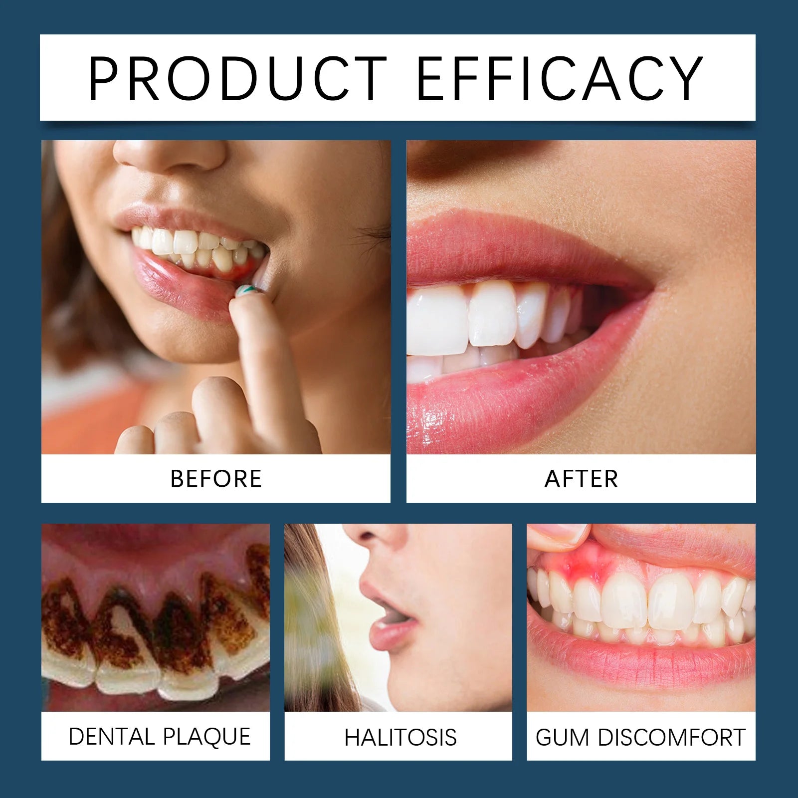 Damaged Gum Repair Care Gel Relieve Sore Gums Allergy Deep Cleaning Teeth Stains Tartar Serum Dental Caries Toothpaste