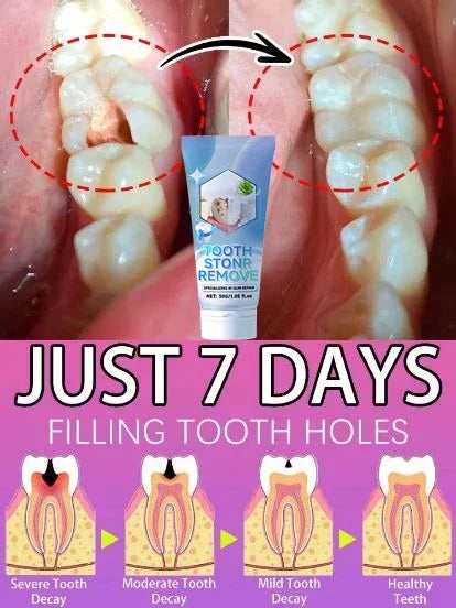Repair gums, relieve gum recession, whiten teeth, remove yellow plaque and cavities toothpaste