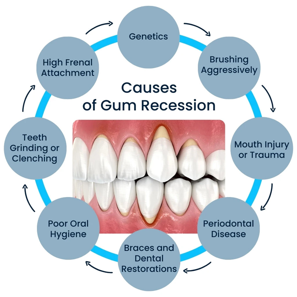 Damaged Gum Repair Care Gel Relieve Sore Gums Allergy Deep Cleaning Teeth Stains Tartar Serum Dental Caries Toothpaste