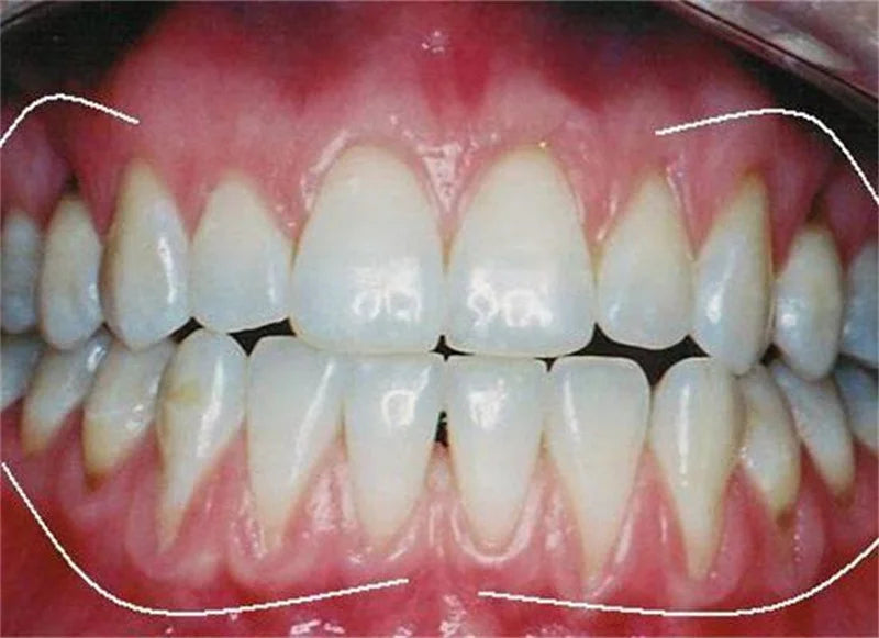Rapid Repair Gums Serum Effectively Relieve Tooth Allergy Dental Caries Tooth Cleaning Toothpaste Relieve Tooth Damage Drops
