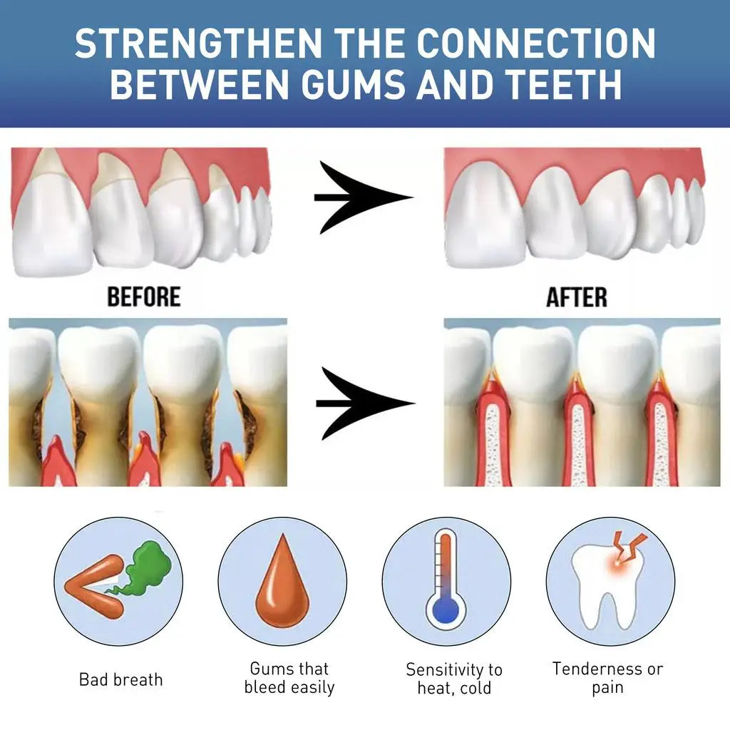 Damaged Gum Repair Care Gel Relieve Sore Gums Allergy Deep Cleaning Teeth Stains Tartar Serum Dental Caries Toothpaste