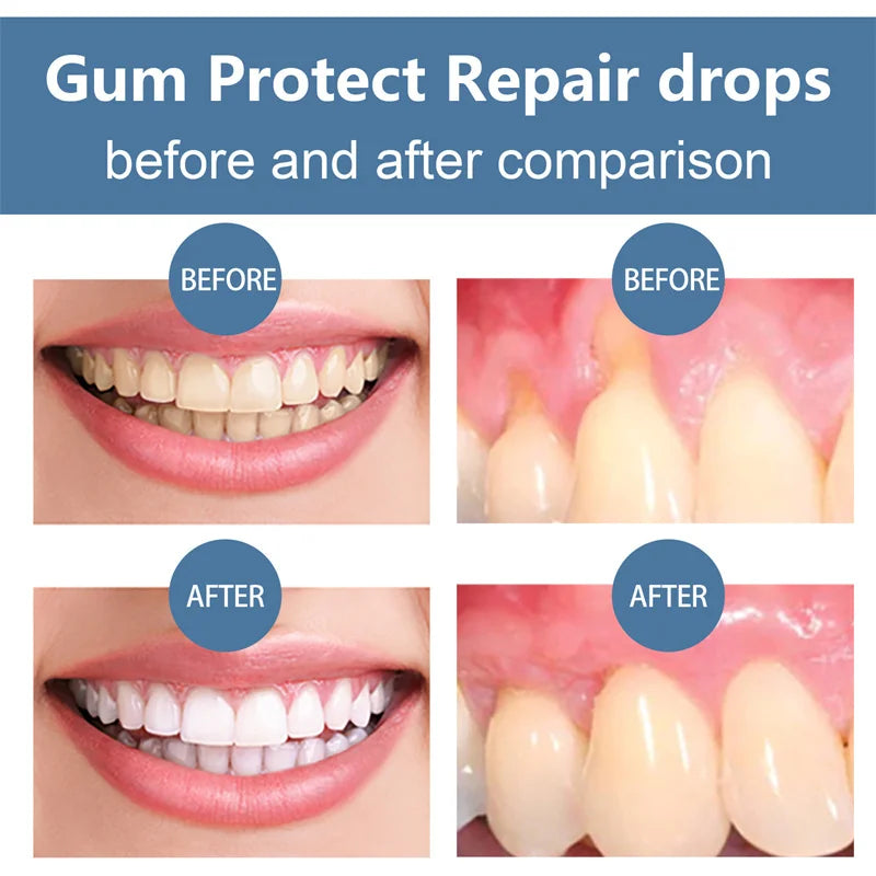 Rapid Repair Gums Serum Effectively Relieve Tooth Allergy Dental Caries Tooth Cleaning Toothpaste Relieve Tooth Damage Drops