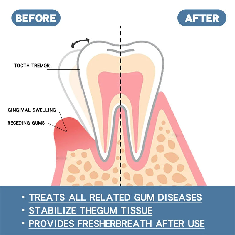 Rapid Repair Gums Serum Effectively Relieve Tooth Allergy Dental Caries Tooth Cleaning Toothpaste Relieve Tooth Damage Drops