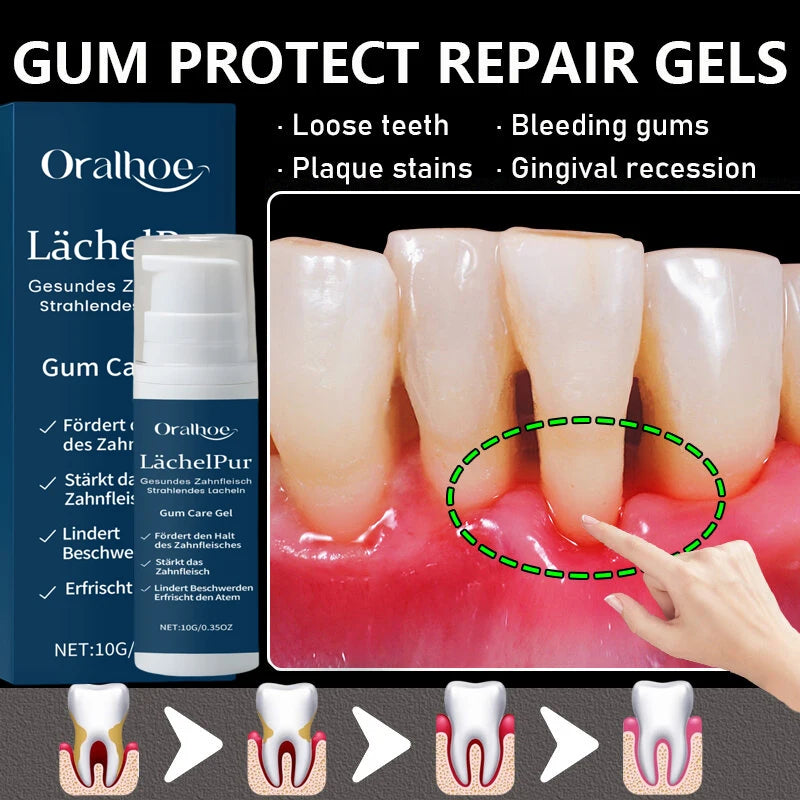Damaged Gum Repair Care Gel Relieve Sore Gums Allergy Deep Cleaning Teeth Stains Tartar Serum Dental Caries Toothpaste