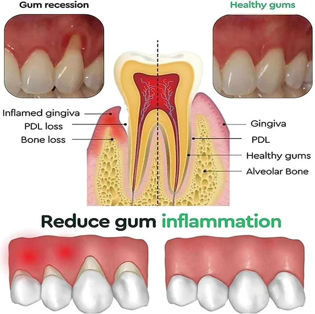 Damaged Gum Repair Care Gel Relieve Sore Gums Allergy Deep Cleaning Teeth Stains Tartar Serum Dental Caries Toothpaste