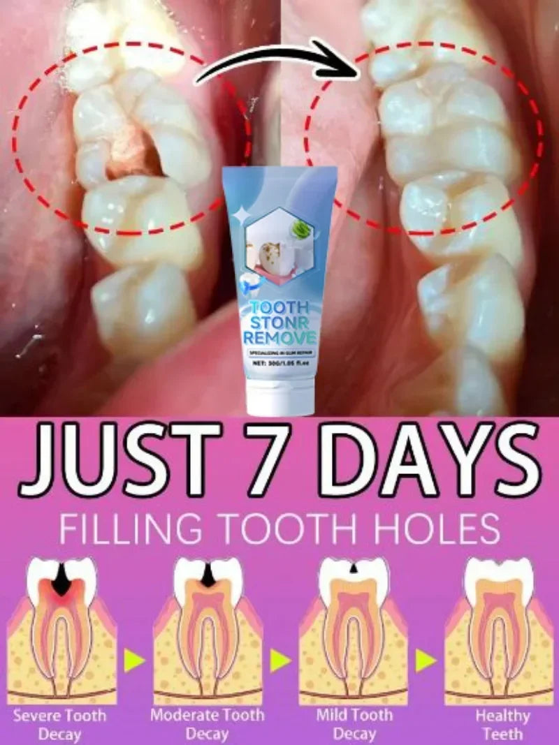 Repair gums, relieve gum recession, whiten teeth, remove yellow plaque and cavities toothpaste