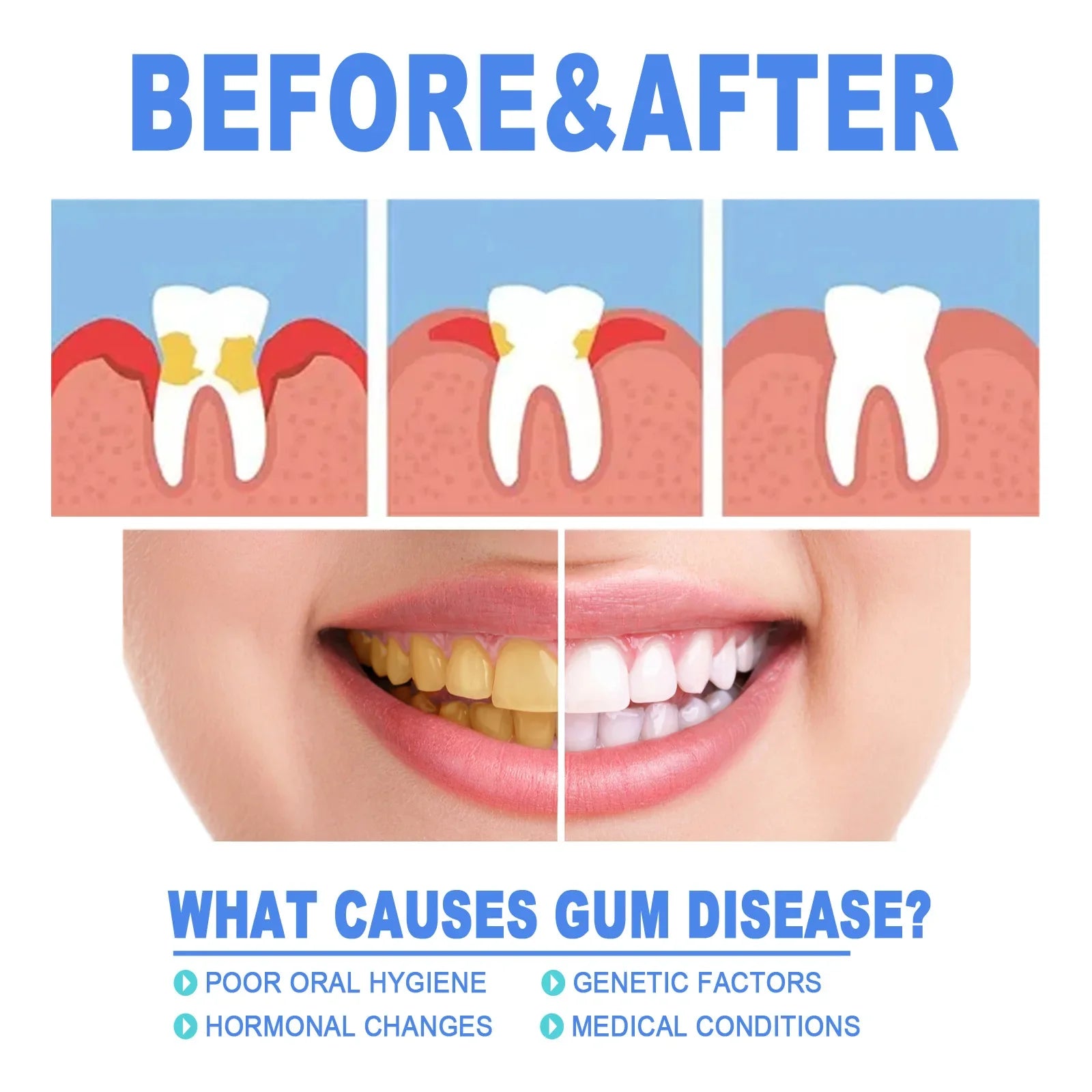 Gum Repair Gel Rebuilding Strengthen Whiten Remove Tooth Stains Anti Gingival Inflammation Recession Bad Breath Protect Oral Gel