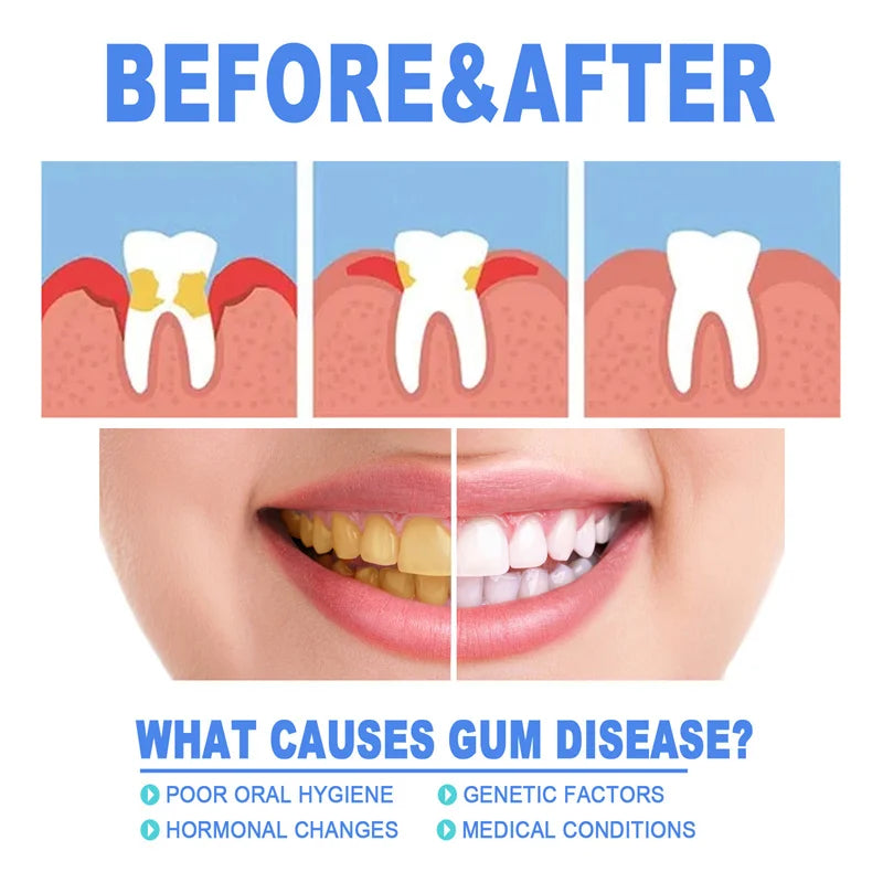Rapid Repair Gums Serum Effectively Relieve Tooth Allergy Dental Caries Tooth Cleaning Toothpaste Relieve Tooth Damage Drops